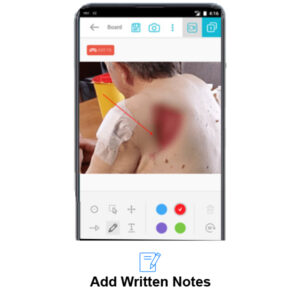 Add notes